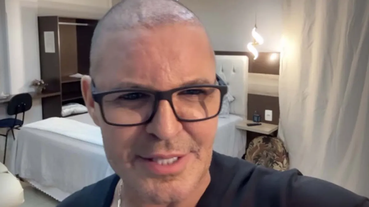 Eduardo Costa apareceu careca em show e nas redes