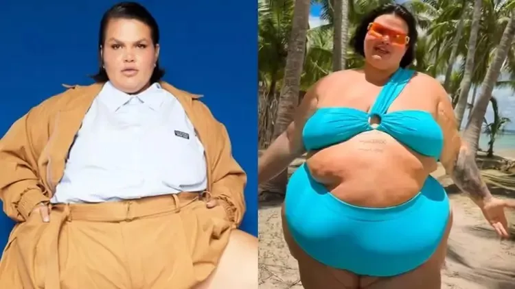 Thais Carla realizou uma cirurgia bariátrica