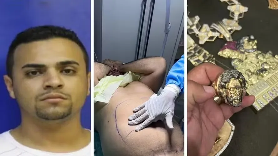 "Professor" passou por lipoaspiração dentro de casa e realizou implante para ficar parecido com personagem homônimo da série 'La Casa de Papel'