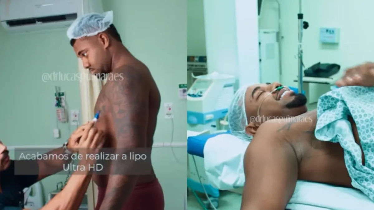 Davi Brito passou por uma lipoaspiração