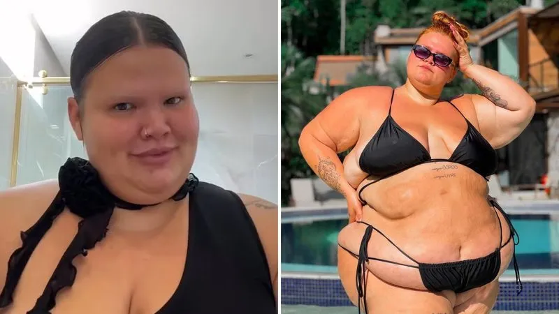 Thais Crala realizou a cirurgia bariátrica