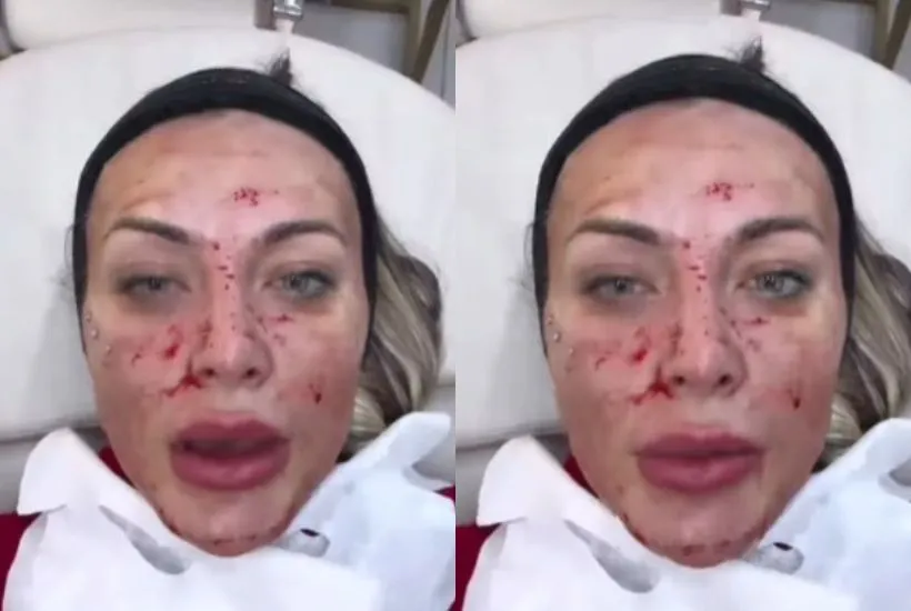 Andressa Urach assustou os seus seguidores