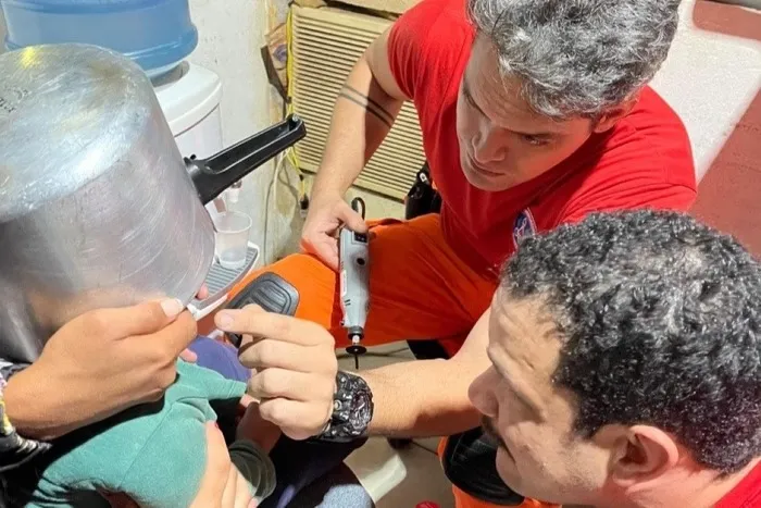 Após a retirada bem-sucedida da panela, a criança ficou sob os cuidados da avó