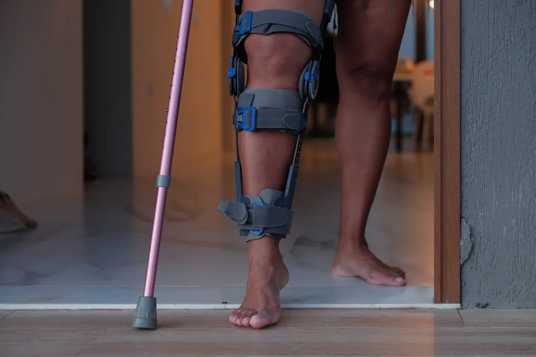Detalhe do joelho lesionado de mulher que alega avaliação médica equivocada por três vezes consecutivas