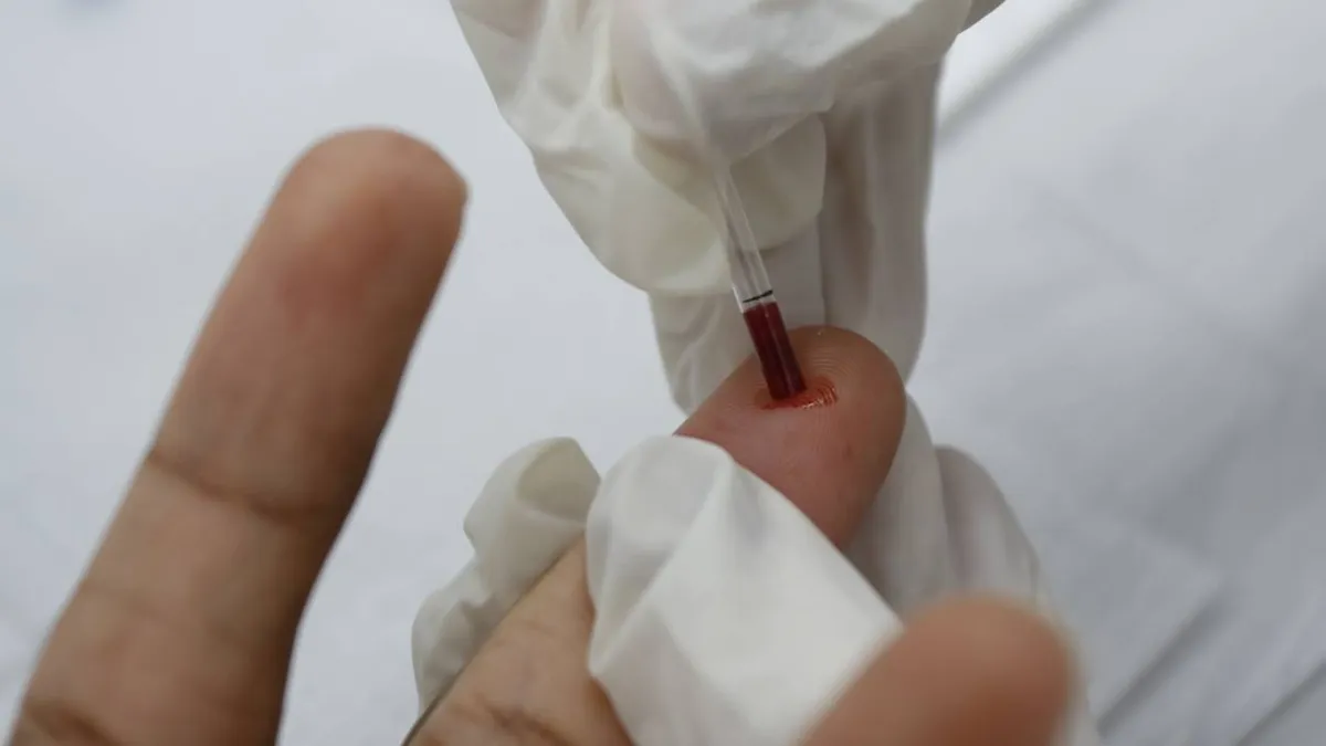 Mais testes rápidos de HIV podem explicar aumento de casos