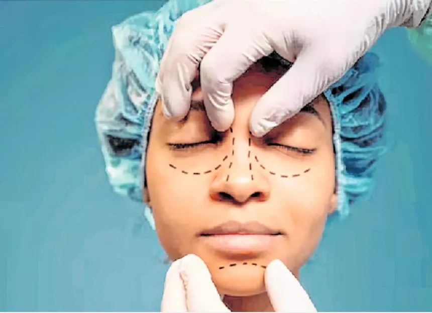 Imagem ilustrativa da imagem Blefaroplastia conquistou o topo do ranking das operações plásticas