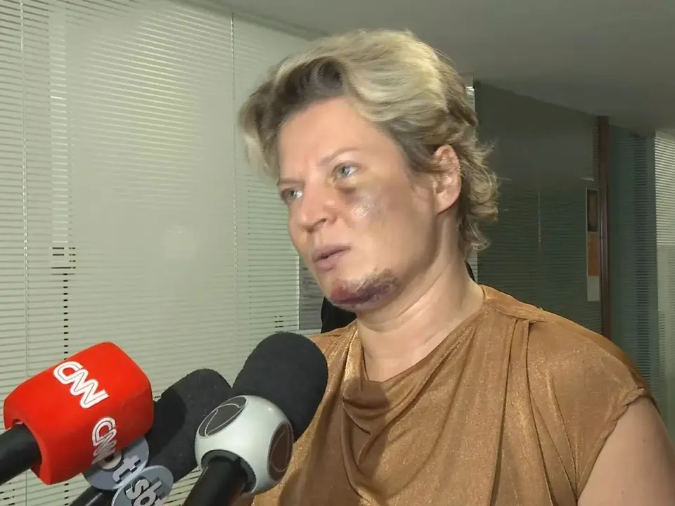 Joice Hasselmann apareceu machucada em julho de 2021