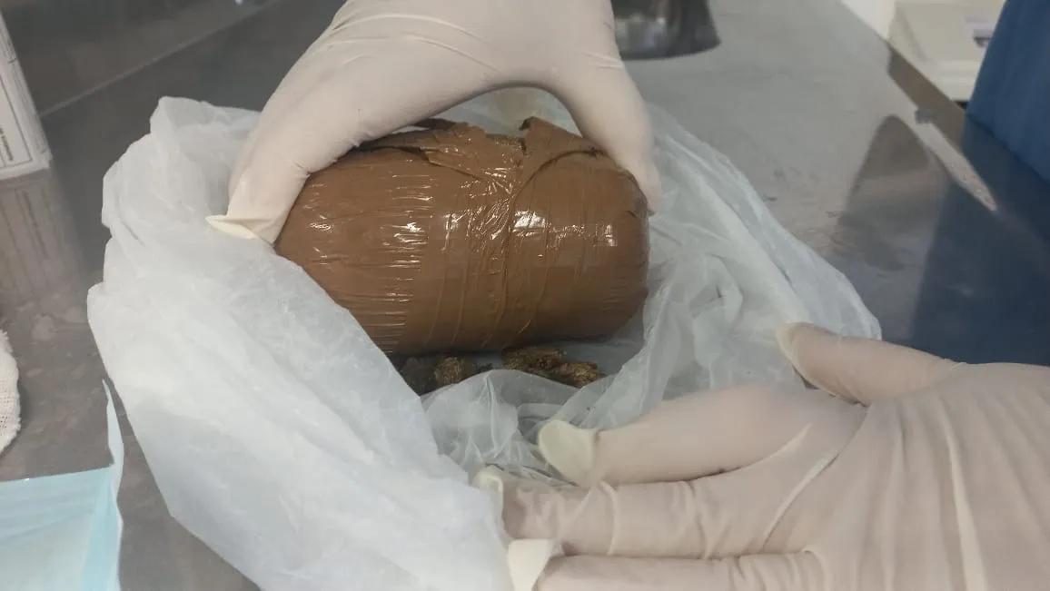 O invólucro de maconha foi removido das partes íntimas da mulher
