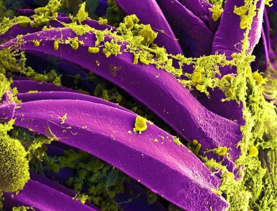 Peste é uma doença infeciosa causada pela bactéria Yersinia pestis