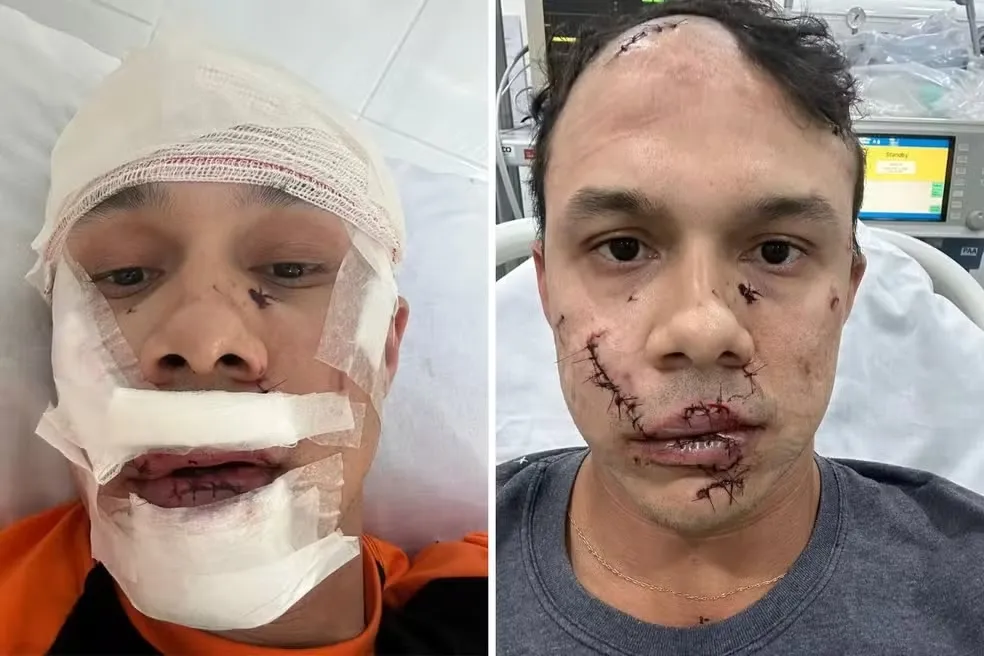 Thiago foi agredido após defender umas mulheres que estavam sendo vítimas de importunação