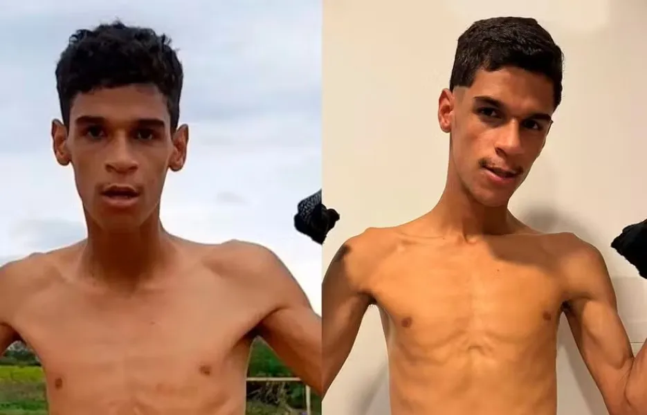 Luva de Pedreiro foi internado na última terça