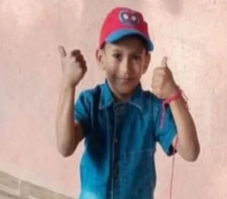 Menino foi picado no último sábado, 2