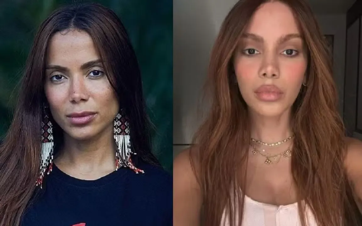Anitta mudou drasticamente o rosto