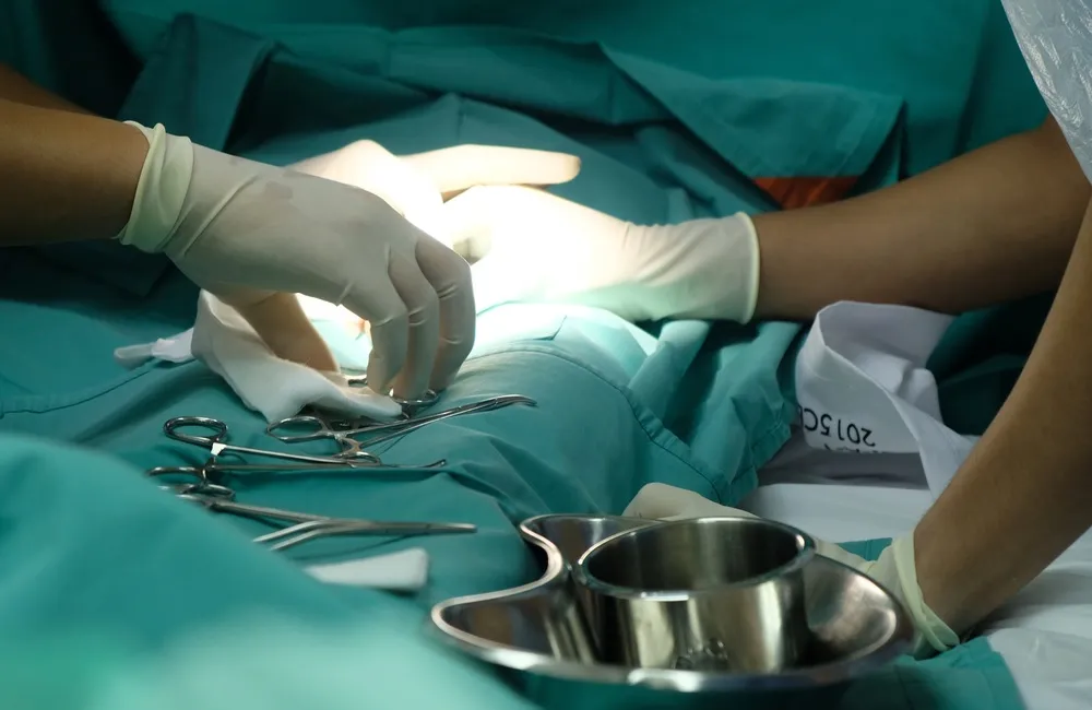 Circuncisão médica masculina pode reduzir em cerca de 60% o risco de infecção pelo HIV, diz estudos