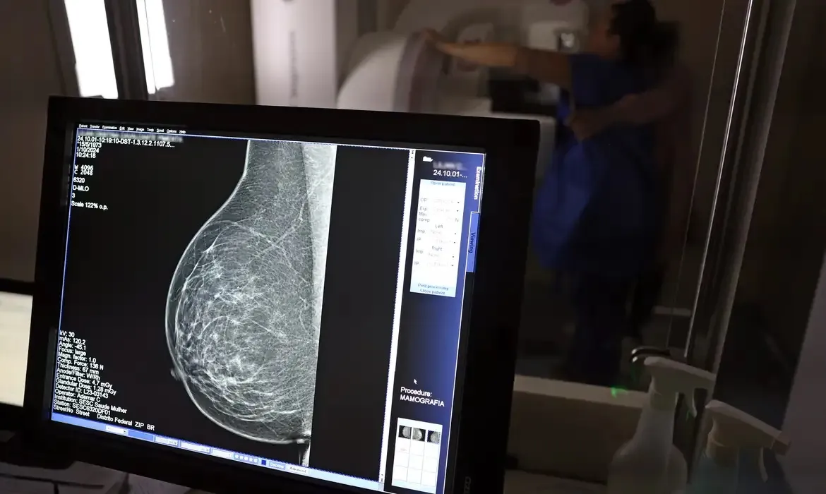 Mulheres com idades entre 40 e 49 anos representam 23% dos casos de doença no país