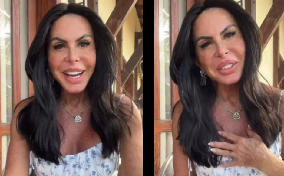 Gretchen aparece em redes sociais com novos proocedimentos estéticos