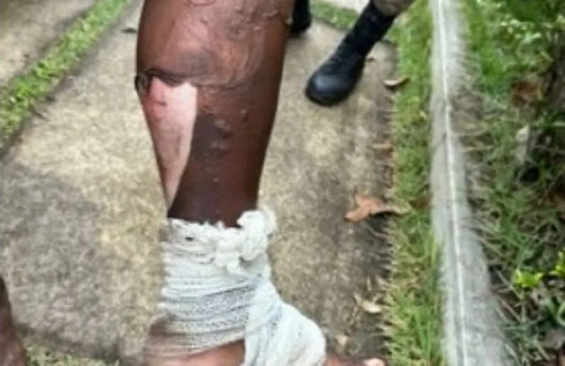 Homem joga álcool em mulher e atea fogo