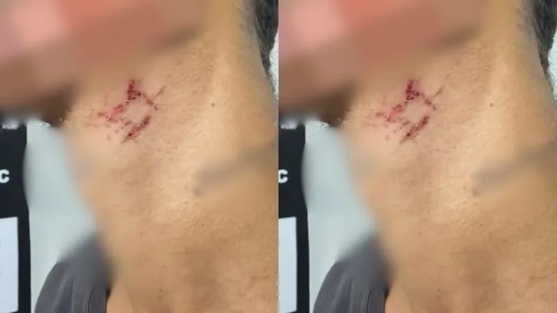 Vítima foi resgatada por equipes do Denarc