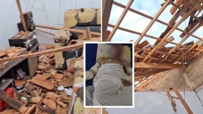 Homem teve queimaduras de 2º e 3º graus