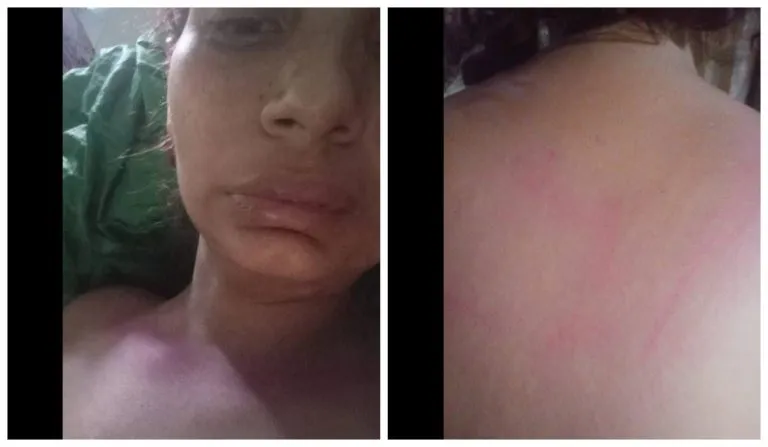 Jovem afirmou ter sido vítima de estupro coletivo em 18 de agosto