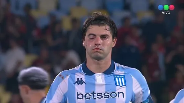 Jogador ficou com o olho inchado e o nariz sangrando