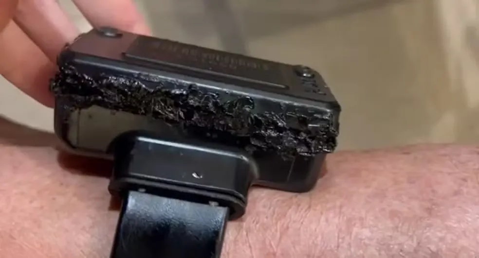 Bolsonaro tentou arrancar tornozeleira eletrônica com ferro de soldar