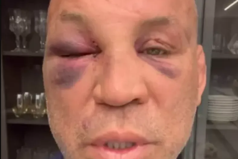 Pentacampeão mundial, Wanderlei Silva revela drama de saúde e tristeza após agressão. "Estou magoado por dentro e por fora", disse sobre confusão com equipe de Popó.