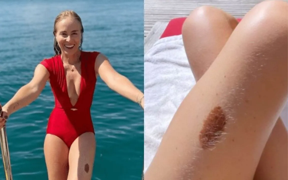 A famosa falou abertamente sobre o trauma