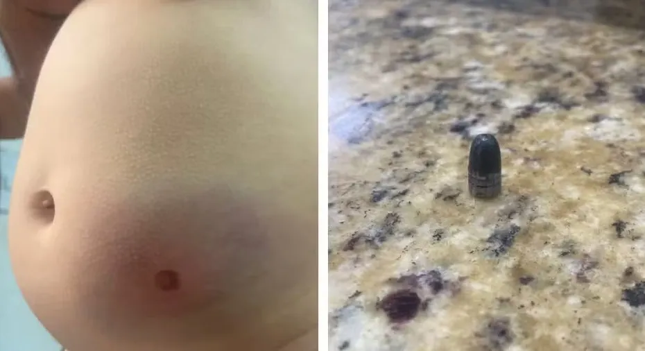 Imagem ilustrativa da imagem Bebê de 11 meses é vítima de bala perdida dentro de casa no revéillon