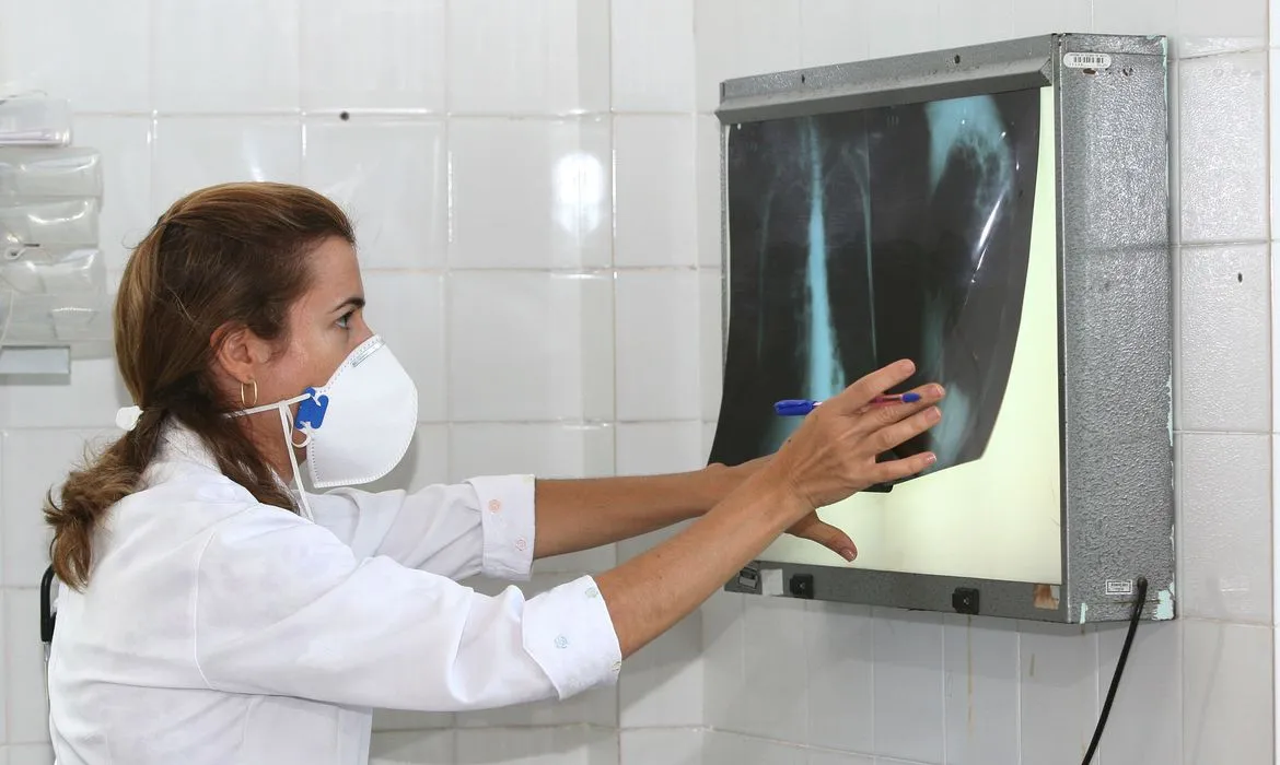 Tuberculose tem aumento em casos no Brasil