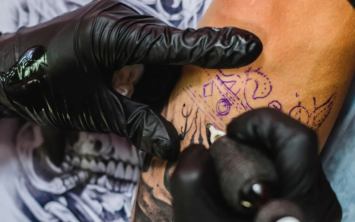 A alergia foi severa e trouxe consequências para o rapaz