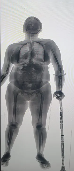 Idosa estava com material escondido na moleta e sandália