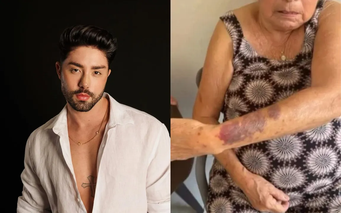 O famoso contou detalhes do caso