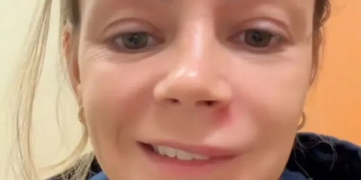 Melhora começou a ser percebida em 24 horas, apesar do sorriso ainda torto