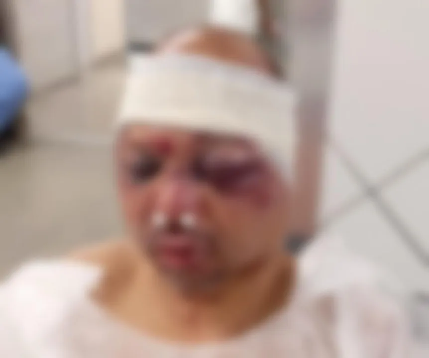 Imagem ilustrativa da imagem Rodoviário de Salvador é espancado por moradores após suspeita de aliciar adolescente