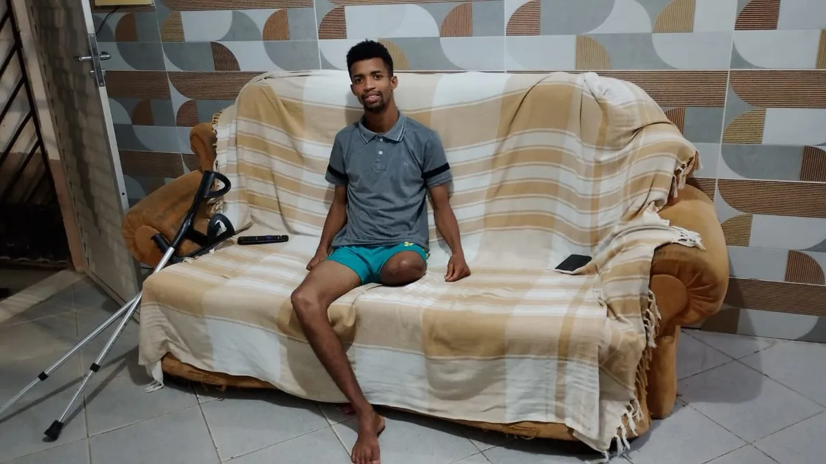 Mateus Araújo teve a perna amputada depois de levar um tiro de fuzil disparado por um PM