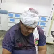 Brigadista atingido com golpe de facão na cabeça