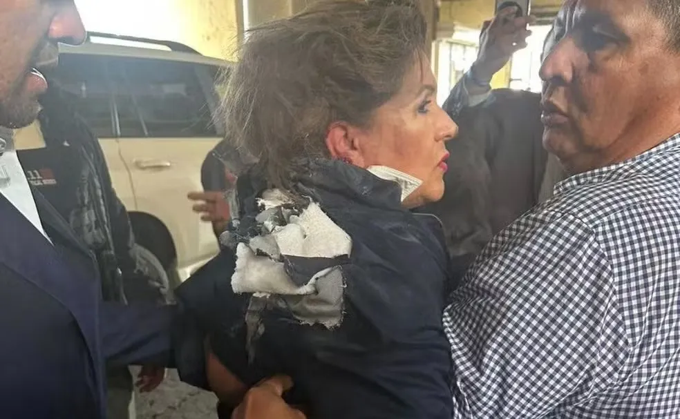 Imagem ilustrativa da imagem Vídeo: deputada é atingida por explosivo na cabeça durante entrevista