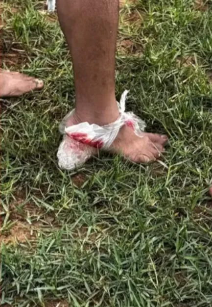 Caso segue sendo acompanhado pelas autoridades municipais