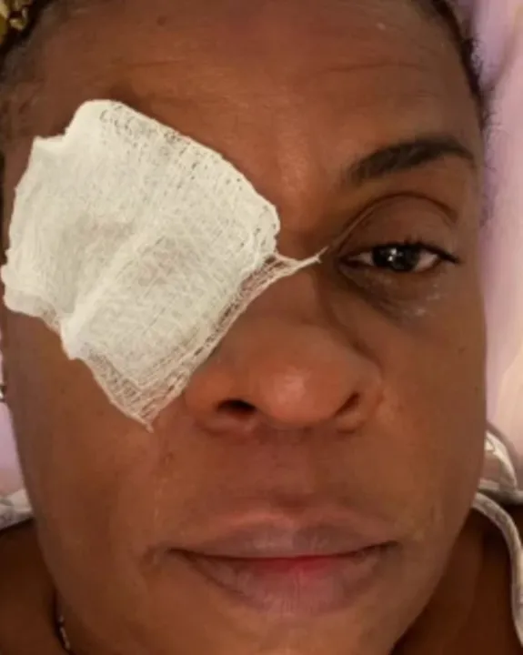 Cacau Protásio perdeu parte da visão após uso de pomada capilar