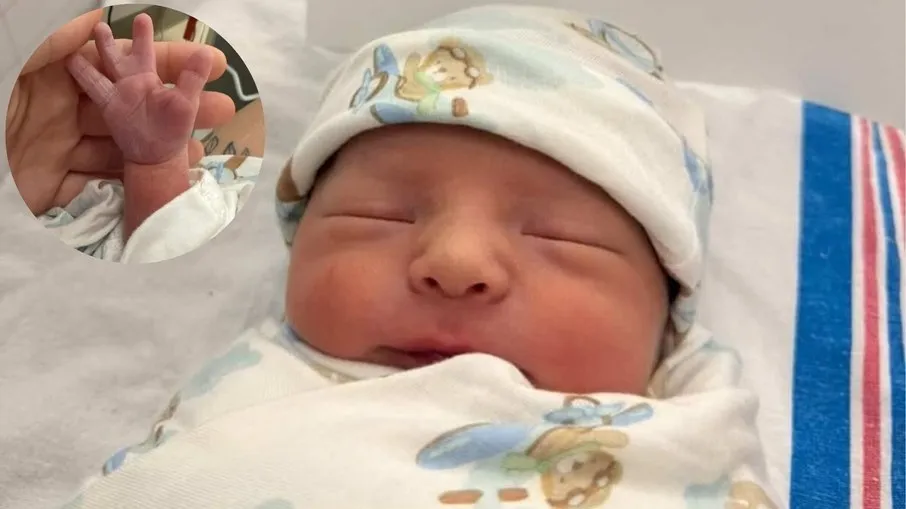 Bebê nasceu com a diferença congênita