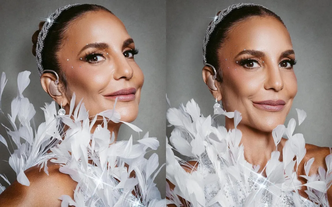 A artista caiu em casa e machucou a face