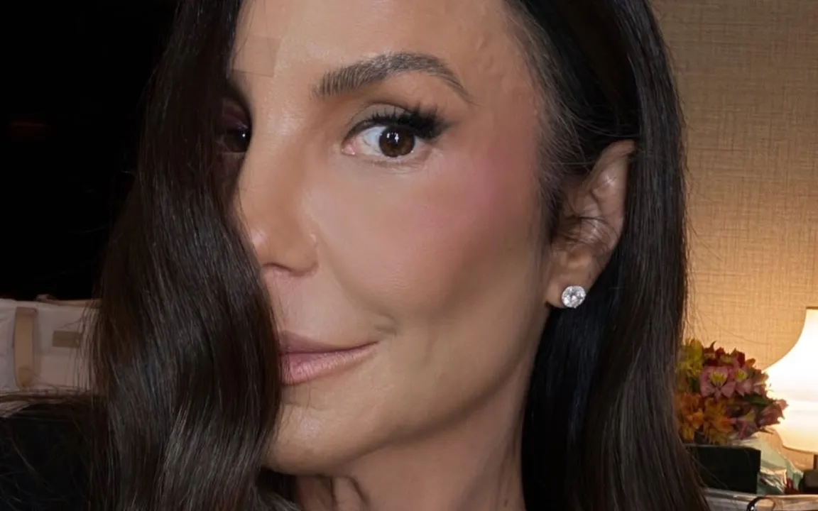 A artista se machucou em casa