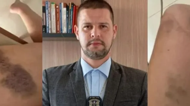 Delegado deve entregar arma imediatamente