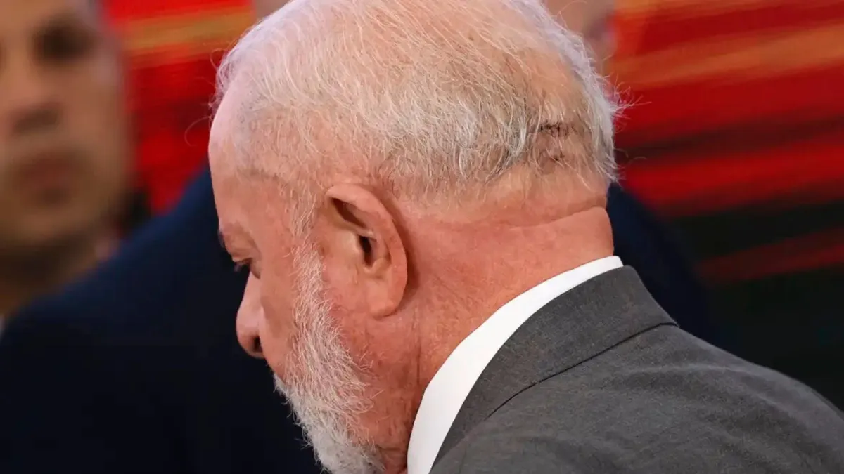 Lula removeu câncer de pele na cabeça