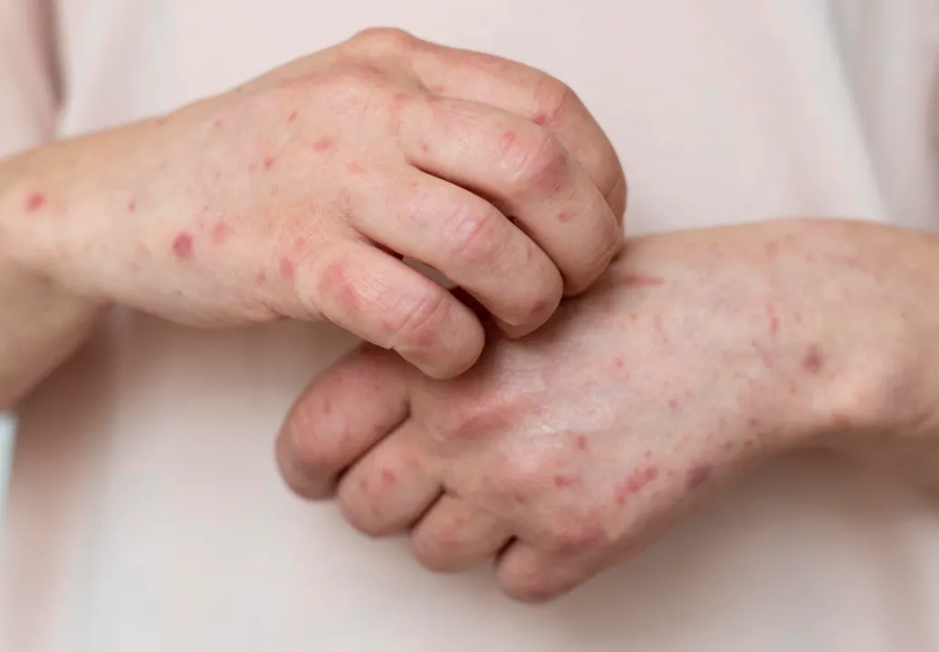 Situação foi classificada como de atenção máxima em oito estados