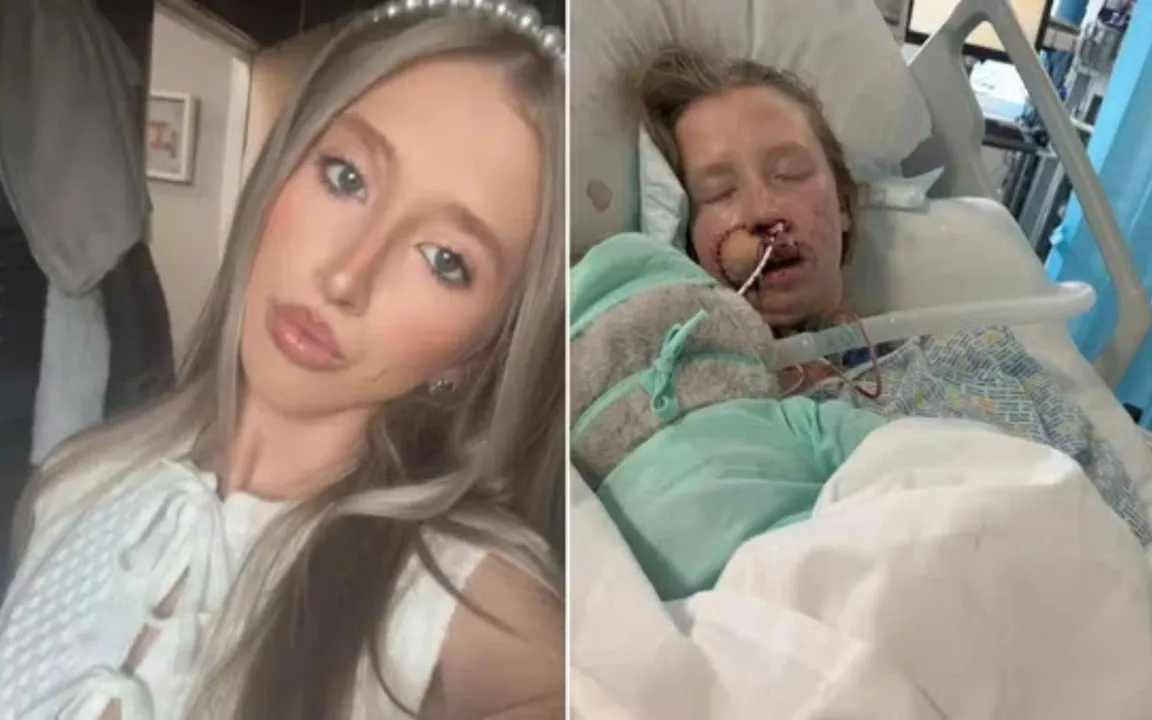 Reegistro da jovem antes e depois do ataque