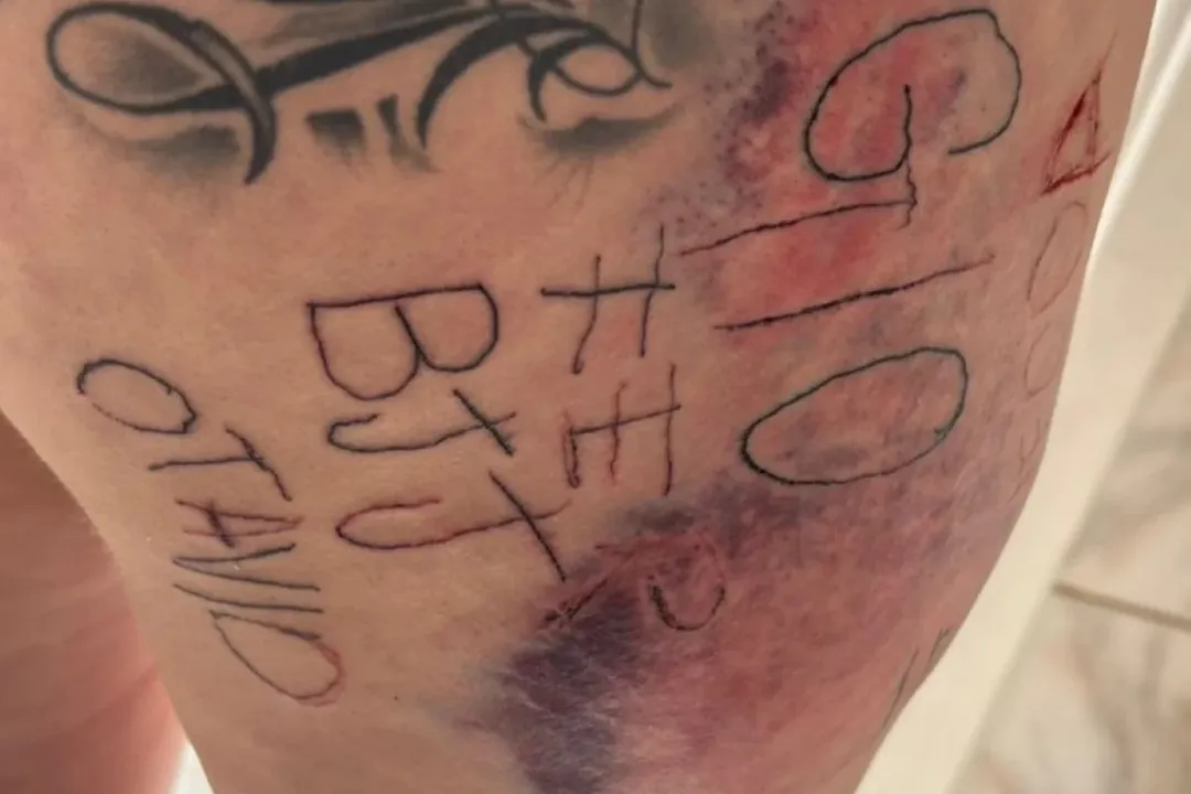 Imagem ilustrativa da imagem Mulher é torturada, tatuada à força e agredida por companheiro