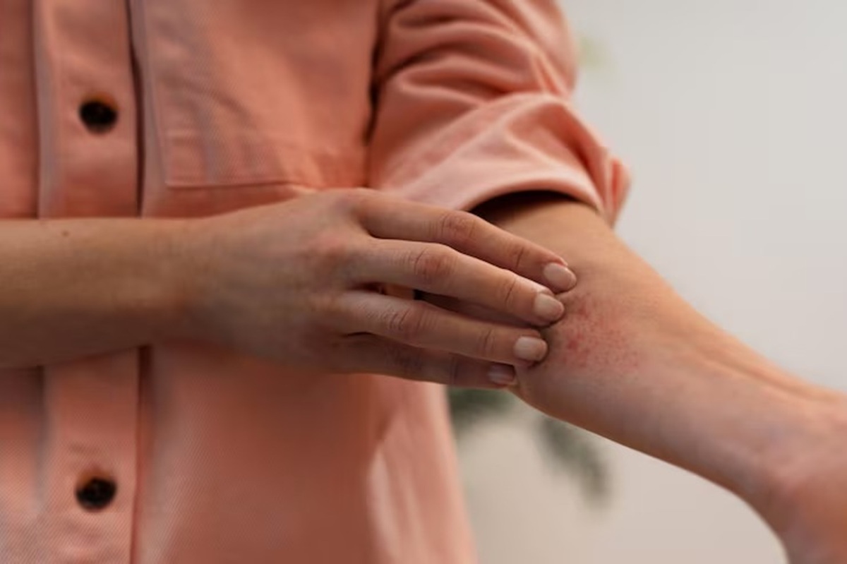 Coceira no corpo após banho quente e exercício: saiba quando se preocupar