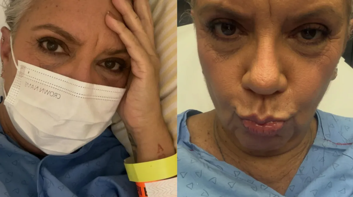 Astrid Fontenelle vai parar no hospital após espinha de peixe